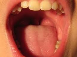 Check spelling or type a new query. Where Does Saliva Come From Questions Naked Scientists