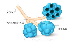 La bronchiolite est une inflammation des bronchioles, les plus petits passages d'air des poumons. Bronchiolite Les Bons Gestes Et Les Bons Reflexes