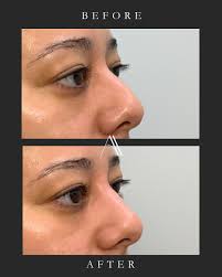 ATELIER AESTHETICS MIAMI (@atelieraestheticsmiami) · Miami, FL