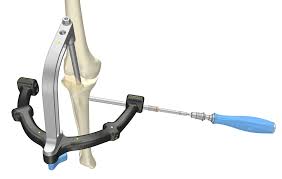 Zimmer Natural Nail Angled Tip Awl 7mm