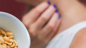 Food allergies are not the same as food intolerances, and food allergy symptoms overlap with symptoms of other medical conditions. Food Allergy Rash Other Symptoms Management And Treatments