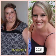 weight loss after gastric surgery