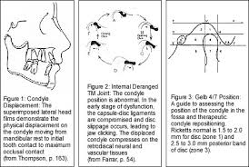 treating tmj in the orthodontic practice orthodontic products