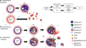Ductal means that the cancer starts inside the milk ducts, carcinoma refers to any cancer that begins in the skin or other tissues (including breast tissue) that cover or line the internal organs, and in situ means in its original place. How Did We Get There The Progression From Ductal Carcinoma In Situ To Invasive Ductal Carcinoma Springerlink