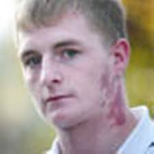 Man mugged during fit