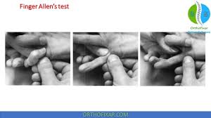 Image result for Allen Test