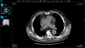 Pin On Health Medication