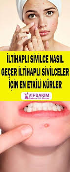 Iltihapli Sivilce Nasil Gecer Vipbakim Sivilce Izi Cilt Urunleri Akne Tedavisi