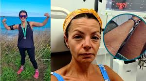 Image result for Exercise-Induced Anaphylaxis