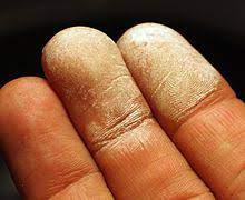 Hydrogen Peroxide Wikipedia