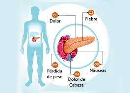 Sintomas Y Tratamientos Para Enfermedades Del Pancreas El Pancreas Pancreas Inflamado Dolor De Pancreas