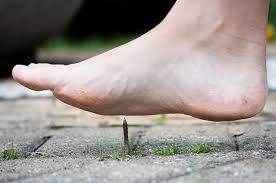 Asam urat tinggi pergelangan kaki sangat sakit hanya minta di terapi sebagian lutut. Ini Penyebab Plantar Fasciitis Dan Cara Ampuh Mengatasinya