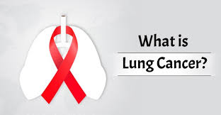 Small cell lung cancer lung cancer small cell grows and spreads rapidly, and in most cases are diagnosed in heavy smokers. What Is Lung Cancer Survival Rate Causes Stages And Diagnosis