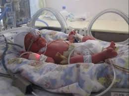 Her doctor implanted all of them inside her womb at once. A Day In The Life My Twins Were Born At 34 Weeks