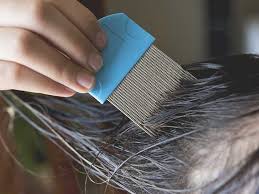 Have you been looking for lice removal salon near me? Drug Resistant Super Lice Symptoms Treatment And Prevention