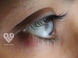 We did not find results for: How To Get Rid Of A Stye Eye Pimple 3 Home Remedies Peppy Blog