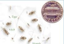 Head Lice Facts 101 Do S Don Ts What No One Tells You