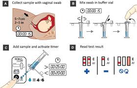 Image result for AmniSure ROM Test
