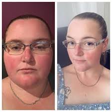 Kylie's weight loss journey