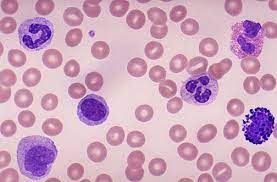 Your blood is a soup of different kinds of cells, and around 1 % of these cells are immune cells also known as white blood cells. Blood Cells Under The Microscope Diagram Quizlet