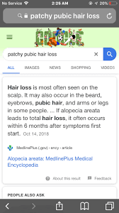 Research suggests that hair loss during menopause is the result of a hormonal imbalance. Pubic Hair Loss Any One March 2019 Babies Forums What To Expect