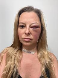 Inspiring story of overcoming adversity