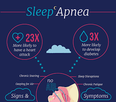 Image result for Sleep Apnea