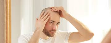 Discover hair loss causes and treatments like shampoos and drugs, as well as how to prevent hair hair loss is extremely common, affecting about 50 million men and 30 million women in the u.s. These Are The Main Reasons For Hair Loss Clinicana