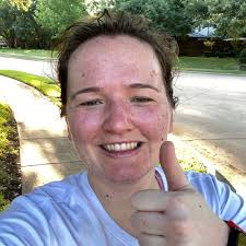 Haley Diamond, Senior Specialist, Dallas 🧪 “When I was first diagnosed  with type 1 diabetes, I was completely blindsided. Like many people, I  assumed type 1 diabetes was a juvenile condition –