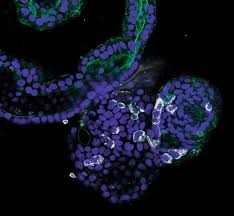 Organoids demonstrate gut infection by SARS-CoV-2 | Nature Reviews  Gastroenterology & Hepatology