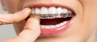 We did not find results for: Info Tekini Harga Kawat Behel Gigi Daftar Harga Tarif