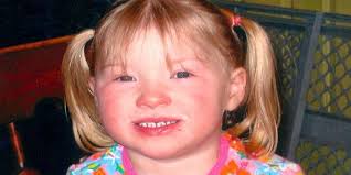 Child recovering from stroke