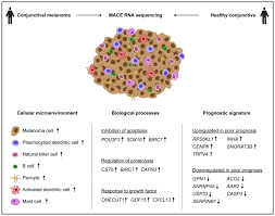 Prostate carcinoma in men with type 2 diabetes has a poorer prognosis and must therefore be diagnosed and treated earlier and more comprehensively than prostate cancer in nondiabetics, said professor arnulf stenzl, md, head. Transcriptional Characterization Of Conjunctival Melanoma Identifies The Cellular Tumor Microenvironment And Prognostic Gene Signatures Scientific Reports