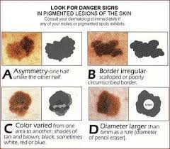 Early detection of skin cancer offers the best chance of survival and successful treatment. Did You Know You Can Get Malignant Melanoma On Your Feet Sutherland Podiatry