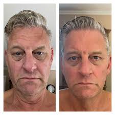 Nu Skin's Retinol (without the reaction) just launched and is ALREADY being  highlighted in all the magazines!! Check out the comments 👇🏼 This gentle  retinol peptide reduces the appearance of discoloration and