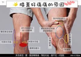 Knee in 原因