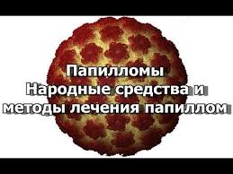 как избавиться от бородавок под мышками в домашних условиях Narodnye Sredstva Ot Papillom Pomogayut Bezboleznenno Udalit Nekrasivye Narosty Kak Izbavitsya Ot Novoobrazovan Domashnie Sredstva Zdorove Ot Prirody Zdorove