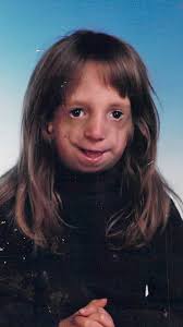 Amber has muscular dystrophy, a disease which causes muscles to deteriorate  over time. Despite this, Amber loves to do cosplay and is showing the world 