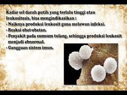Maybe you would like to learn more about one of these? 085 320 602 958 Cara Mengobati Kelebihan Sel Darah Putih Ramuan Herbal Kelebihan Sel Darah Putih Youtube