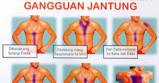 √ verified pass quality & scientific checked by advisor, read our quality control. Cara Mengobati Sakit Jantung Yok Belajar Jadi Pengusaha