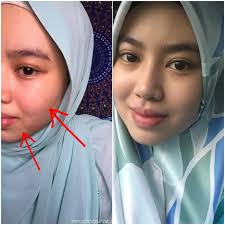 Our nano sensitivity serum has been designed to help prevent and reduce tooth sensitivity. Nano White Serum Review