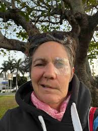 Fundraiser by Simone Beasley : Please help me get my smile back.