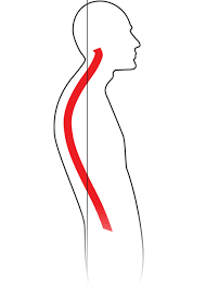 Spine - Kyphosis - Hyperkyphosis - Spinal deformity