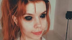 Fratus tenta lugar na final dos 50m. Mulher Perde Quase Toda A Visao Apos Fazer Tatuagem Para Pintar Os Olhos De Preto Istoe Independente