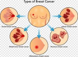 Inflammatory breast cancer usually starts with the reddening and swelling of the breast instead of a distinct lump. Persistent Genital Itch Severe Menstrual Pain May Be Signs Of Cancer Healthwise