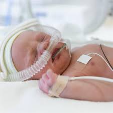 Image result for Preterm Infant