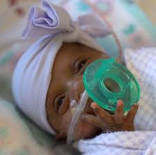 World S Smallest Surviving Premature Baby Released From Hospital