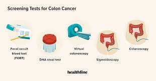 Image result for Colon Cancer Screening with Colonoscopy
