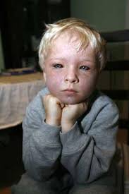 Mitcham boy trapped and turned purple in freak Colliers Wood travelator  accident