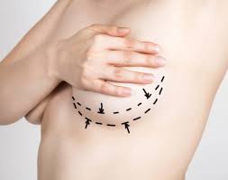 Gynecomastia Surgery In Lethbridge, Alberta